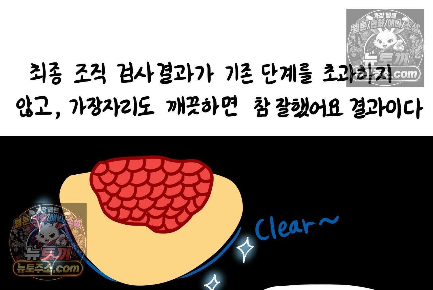 재활용 머학생 105화 수술하는 만화(2) 42