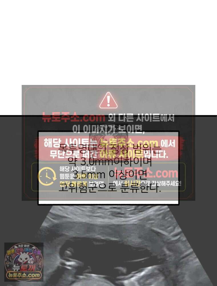 멍냥패밀리 14화 산전 기형아 검사 33
