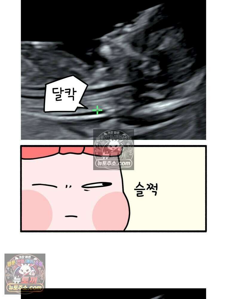 멍냥패밀리 14화 산전 기형아 검사 36