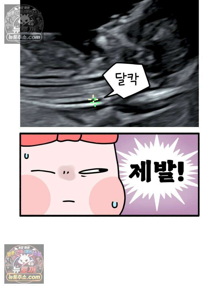 멍냥패밀리 14화 산전 기형아 검사 37