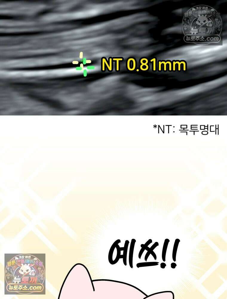 멍냥패밀리 14화 산전 기형아 검사 39