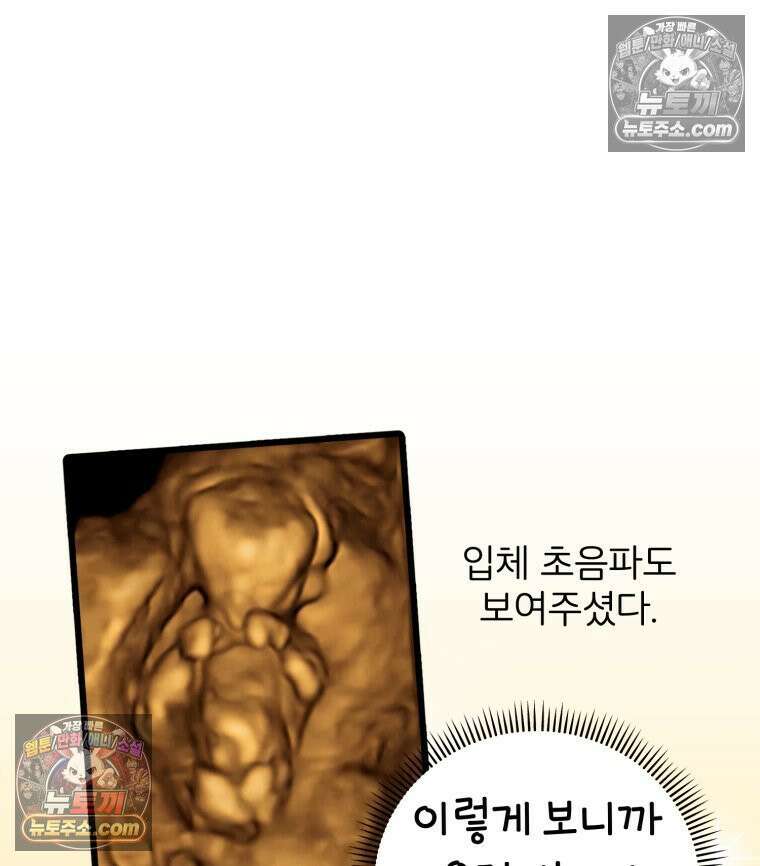 멍냥패밀리 14화 산전 기형아 검사 47
